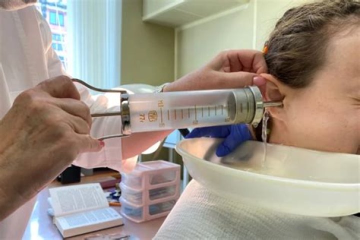 Can a nurse remove impacted cerumen