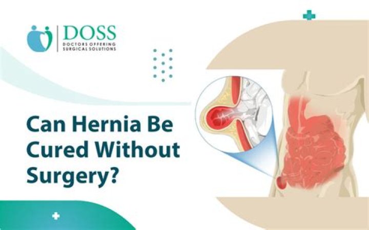 Can hernia belt cure hernia