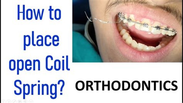 Warren Spring Orthodontics - How To Discuss