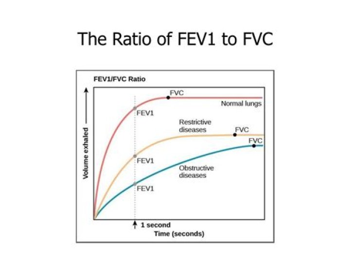 What is a normal fev1 FVC ratio