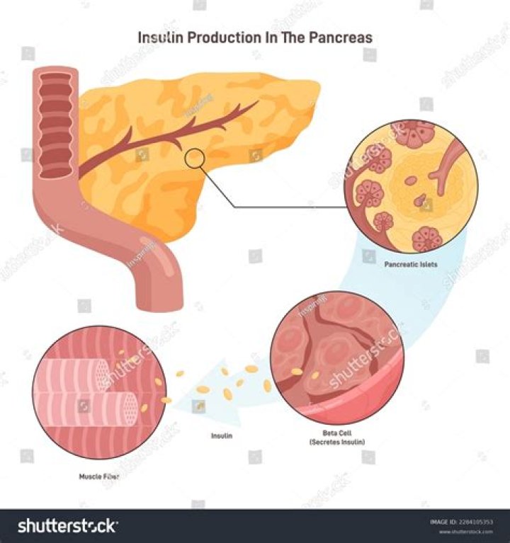 What makes the pancreas stop producing insulin