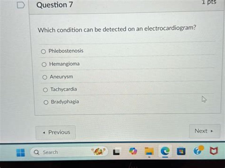 Which condition can be detected on an electrocardiogram