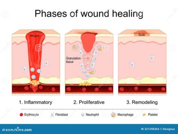 Which phase of wound healing takes the longest
